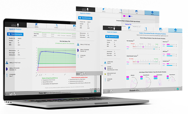 Predict+ Shoulder Outcome Predictor