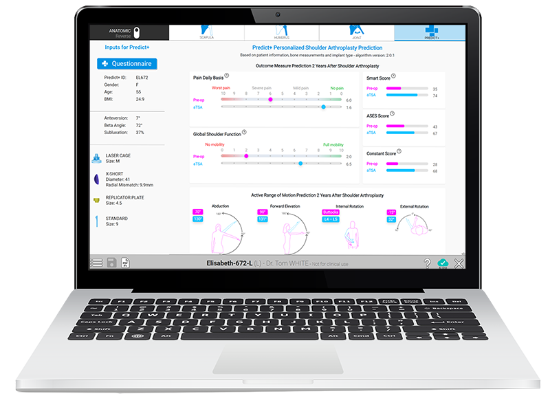 Predict+ Shoulder Outcome Predictor
