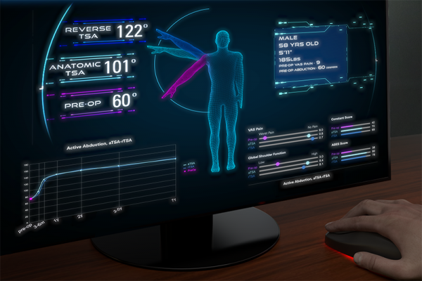 Computer screen is showing Predict+, which is a machine learning tool that helps to better predict patient outcomes