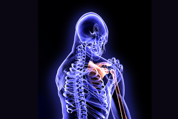 Dr. Muh and Dr. Papandrea share their innovative approaches to shoulder arthroplasty