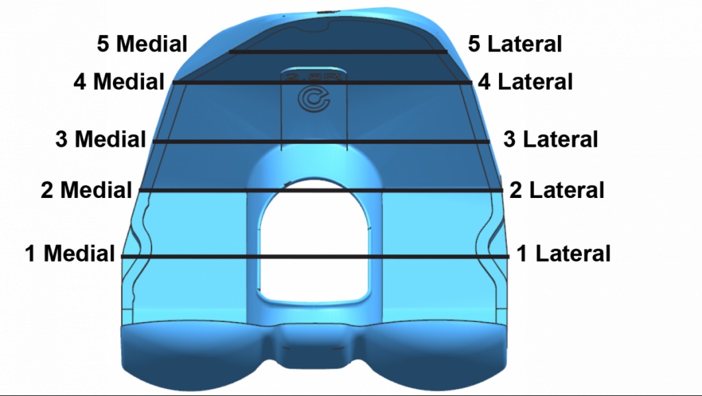 Rendering of Truliant Femoral Component with Lateral and Medial Points
