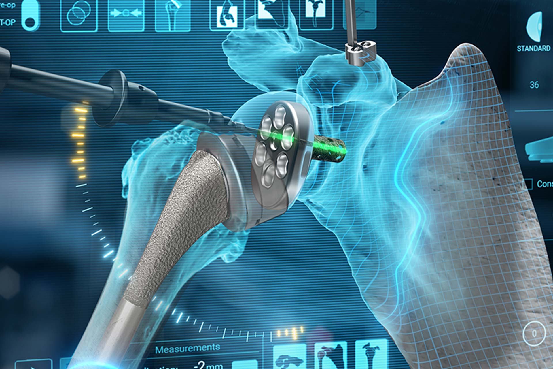 Advita GPS Shoulder and Equinoxe Planning App