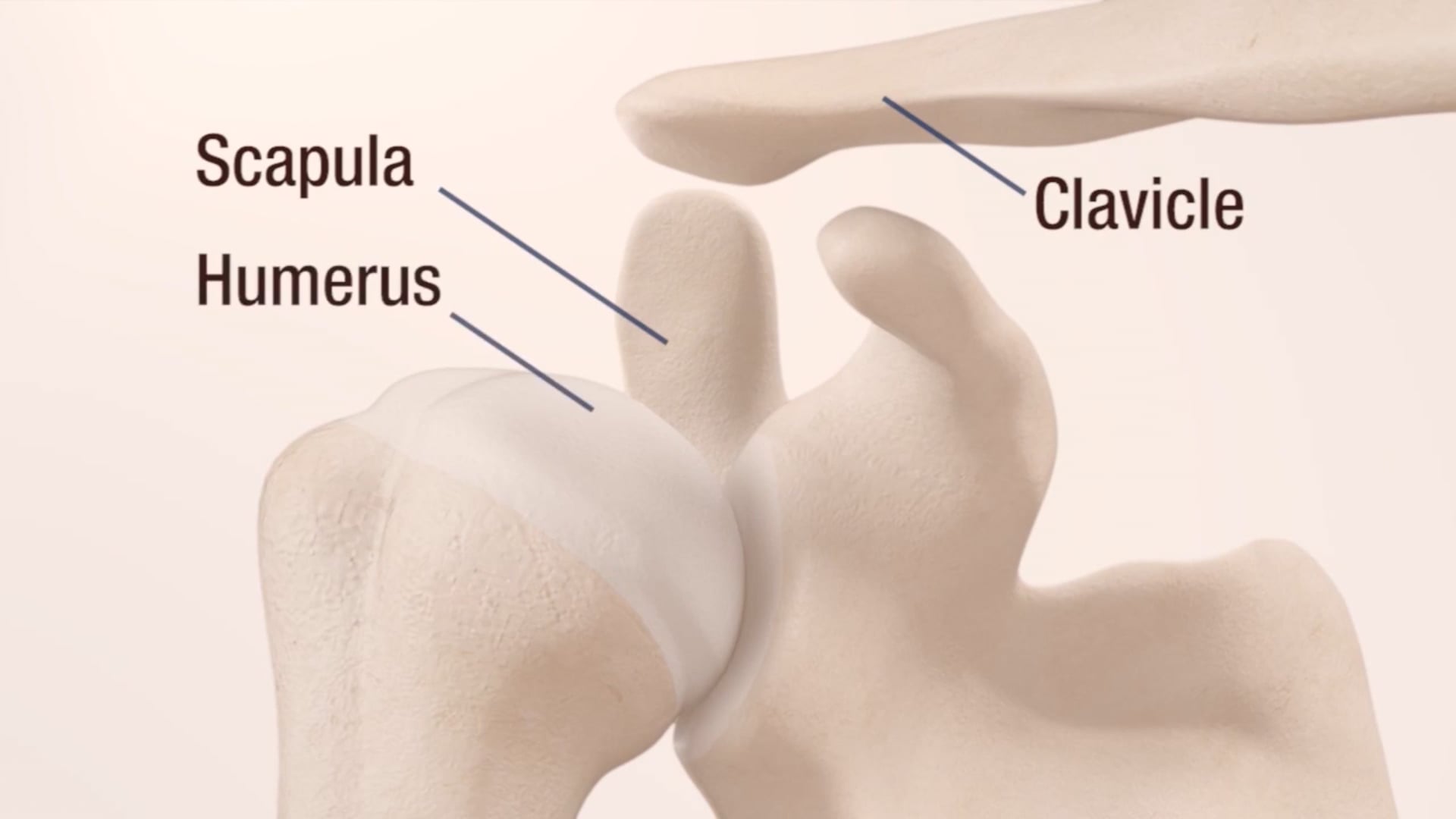 Understanding Primary Shoulder Replacement Patient Animation