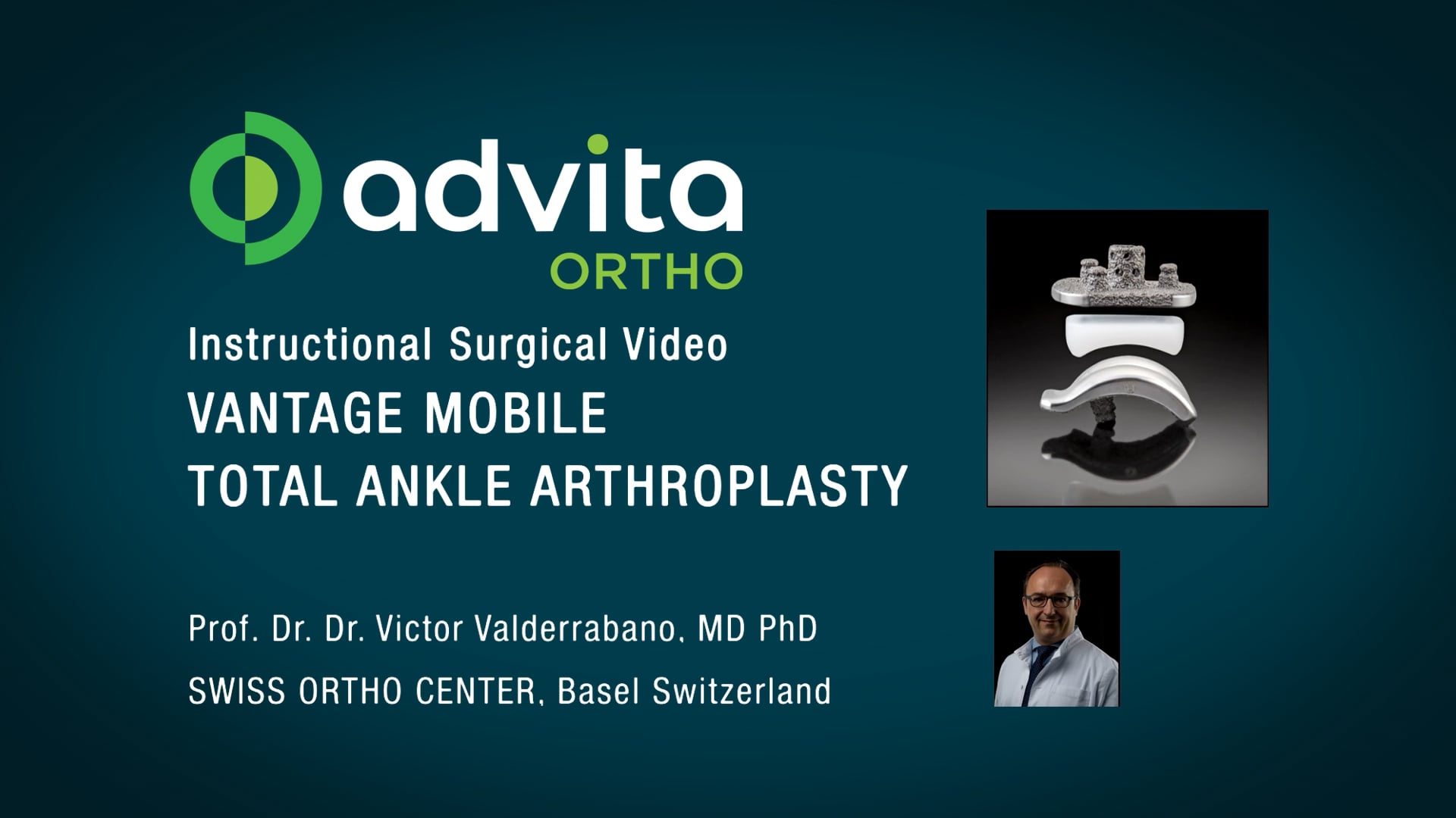 Advita Ortho Vantage Total Ankle Mobile Bearing Surgical Video