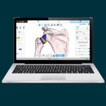 Advita Ortho Active Intelligence Shoulder Planning App